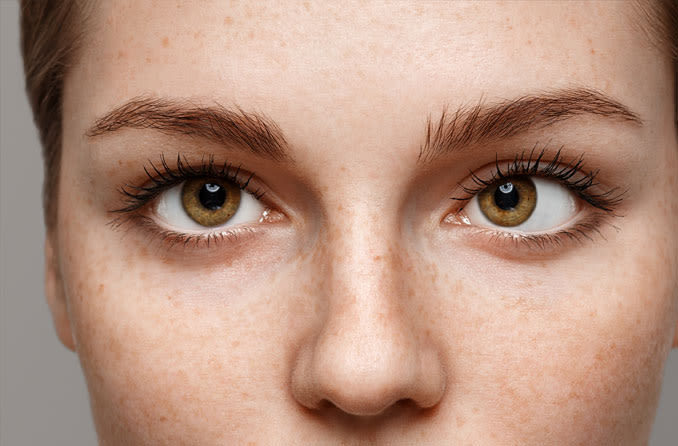 The evolution of strabismus surgery