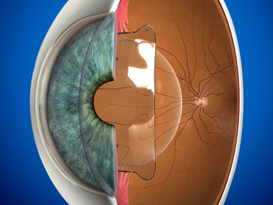 Moatassem-Eye-Clinic-2