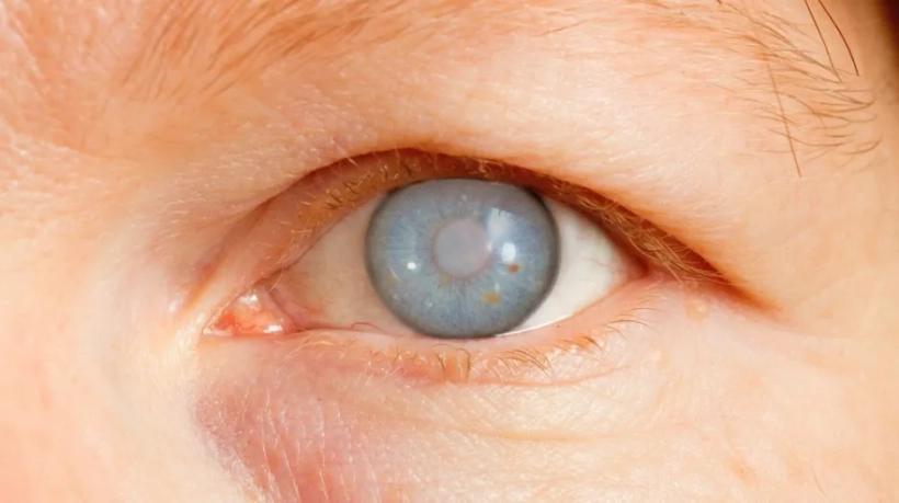 عملية المياه الزرقاء في العين