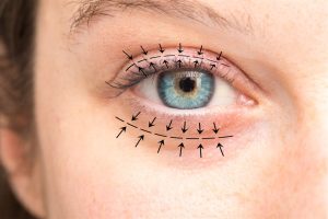 أفضل دكتور تجميل عيون فى مصر