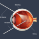 جراحات الشبكية والجسم الزجاجي (Retina & Vitreous Surgery)