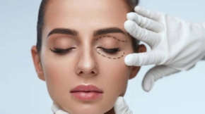 Eye Cosmetic Surgery