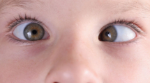 Children Problems & Squint