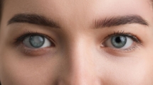 Treatment of Glaucoma