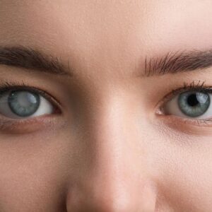 Treatment of Glaucoma