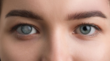 Treatment of Glaucoma